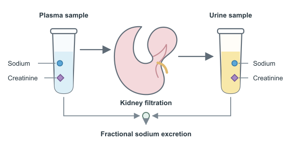 Figure for FENa Calculator (Fractional Excretion of Sodium)